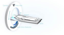 FIGURE 1. In a conventional CT scanner, an x-ray source rotates around the patient. Indirect detectors provide the data from which a 3D image is generated.
